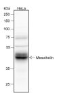Anti-Mesothelin Rabbit mAb