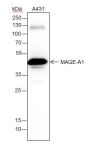 Anti-MAGEA1 Rabbit mAb