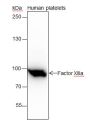 Anti-Factor XIIIa Rabbit mAb
