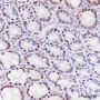 Anti-KLF4 Rabbit mAb