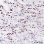 Anti-KLF4 Rabbit mAb