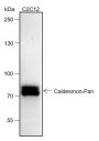 Anti-Caldesmon/CDM Rabbit mAb