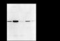 Anti-Thymidylate Synthase Rabbit mAb