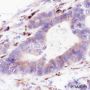 Anti-Thymidylate Synthase Rabbit mAb
