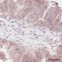 Anti-Thymidylate Synthase Rabbit mAb