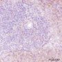 Anti-VPAC2 Rabbit mAb