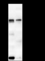 Anti-Androgen Receptor Rabbit mAb (C-terminal)
