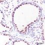 Anti-Androgen Receptor Rabbit mAb (C-terminal)