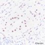 Anti-Androgen Receptor Rabbit mAb (C-terminal)