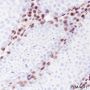 Anti-Androgen Receptor Rabbit mAb (C-terminal)