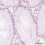 Anti-Androgen Receptor Rabbit mAb (C-terminal)