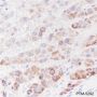 Anti-PDK1 Rabbit mAb
