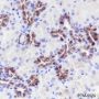 Anti-SATB1 Rabbit mAb