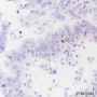 Anti-SATB1 Rabbit mAb