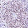 Anti-SATB1 Rabbit mAb