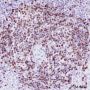Anti-SATB1 Rabbit mAb