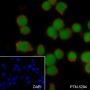 Anti-SATB1 Rabbit mAb