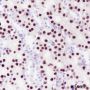 Anti-SATB2 Rabbit mAb