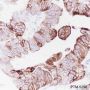 Anti-Keratin 7 Rabbit mAb