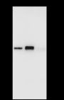 Anti-Keratin 7 Rabbit mAb
