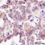 Anti-Phospho-S6 Ribosomal Protein (Ser240/244) Rabbit mAb