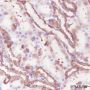 Anti-Phospho-S6 Ribosomal Protein (Ser240/244) Rabbit mAb