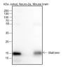 Anti-Stathmin 1 Rabbit mAb