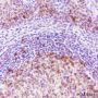 Anti-Stathmin 1 Rabbit mAb