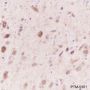 Anti-Stathmin 1 Rabbit mAb
