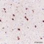 Anti-alpha B Crystallin Rabbit mAb