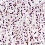 Anti-Dimethyl-Histone H3 (Lys27) Mouse mAb