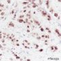 Anti-FOXA1 Rabbit mAb