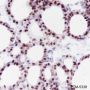 Anti-PAX8 Rabbit mAb