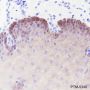 Anti-Keratin 16 Rabbit mAb
