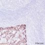 Anti-Keratin 16 Rabbit mAb