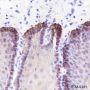 Anti-Keratin 16 Rabbit mAb