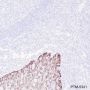Anti-Keratin 16 Rabbit mAb