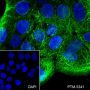 Anti-Keratin 16 Rabbit mAb