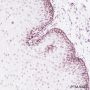 Anti-MSH2 Rabbit mAb