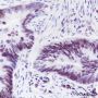 Anti-MSH2 Rabbit mAb