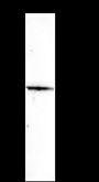 Anti-TRBC1 Rabbit mAb