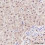 Anti-SETBP1 Rabbit mAb
