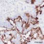 Anti-NaPi2b Rabbit mAb