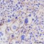 Anti-CD99 Rabbit mAb