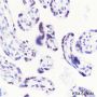 Anti-Crotonyl-Histone H3 (Lys14) Rabbit mAb