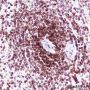 Anti-Crotonyl-Histone H3 (Lys14) Rabbit mAb