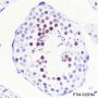 Anti-Crotonyl-Histone H3 (Lys14) Rabbit mAb
