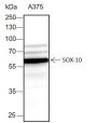 Anti-SOX10 Rabbit mAb