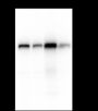 Anti-Hexokinase II Mouse mAb