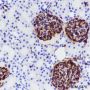 Anti-Vimentin Rabbit mAb